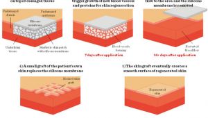 Integra Dermal Regeneration Template Three Dimensional Tissue Cultures and Tissue Engineering