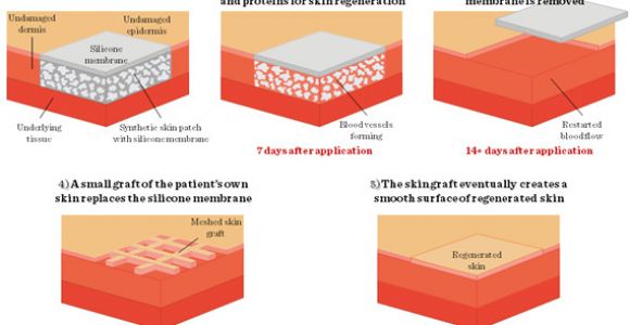 Integra Dermal Regeneration Template Three Dimensional Tissue Cultures and Tissue Engineering