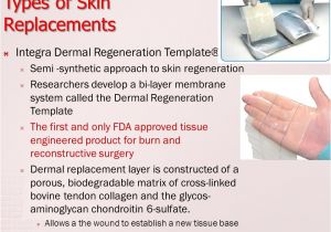 Integra Dermal Regeneration Template Wound Dressing Artificial Skin Ppt Video Online Download