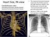Left Cardiac Border X Ray Introduction to Chest Radiology Dr Ruba Khasawneh Ppt