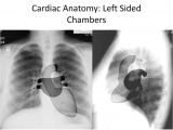 Left Cardiac Border X Ray Introduction to Chest Radiology Dr Ruba Khasawneh Ppt