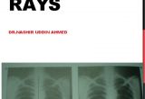 Left Cardiac Border X Ray X Ray Cvs Aorta Heart