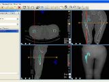 Orthopedic Templating software Surgical Medical software for orthopedic Templating Flickr