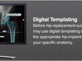 Orthopedic Templating software What is Digital Templating Brainlab org