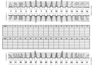 Periodontal Chart Template Perio20298 Periodontal Examination Chart
