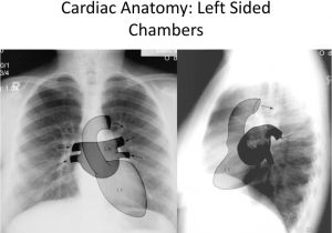 Right Cardiac Border X Ray Introduction to Chest Radiology Dr Ruba Khasawneh Ppt