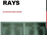 Right Cardiac Border X Ray X Ray Cvs Aorta Heart