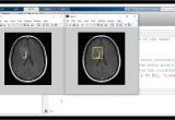 Template Matching In Image Processing Template Matching Image Processing and Computer Vision