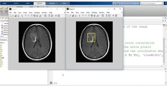 Template Matching In Image Processing Template Matching Image Processing and Computer Vision