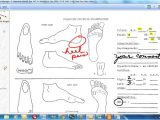 Wound Chart Template 9 Best Images Of Wound Care Chart Color Wound Drainage